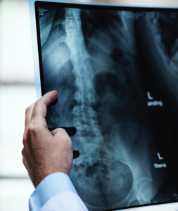 SpinalCord