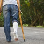 Person in crutches and leg cast walking away