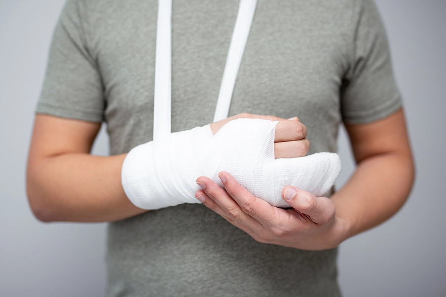Man-with-broken-arm-in-cast-1